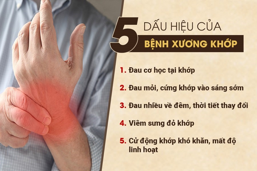 Xuong Khop 2