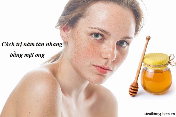 cach-tri-nam-va-tan-nhang-bang-mat-ong.jpg